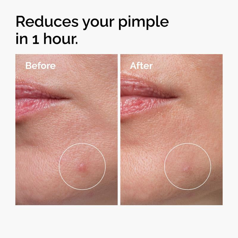 The Congested Skin Collection