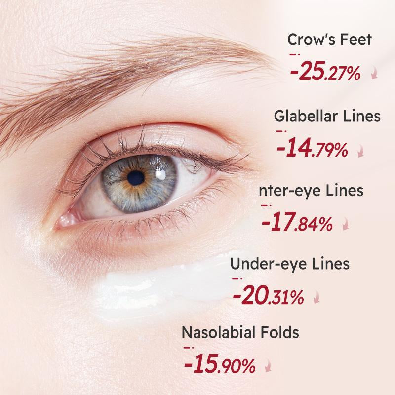 [Youthpulse Official] Retinol Eye Cream for Face & Neck / Peptides / Anti-Wrinkle, Anti-Aging, Brightening & Hydrating/ Helps Reduce Fine Lines & Dark Circles / Plumps, Firms & Lift Hydrate Daily Restore Gentle